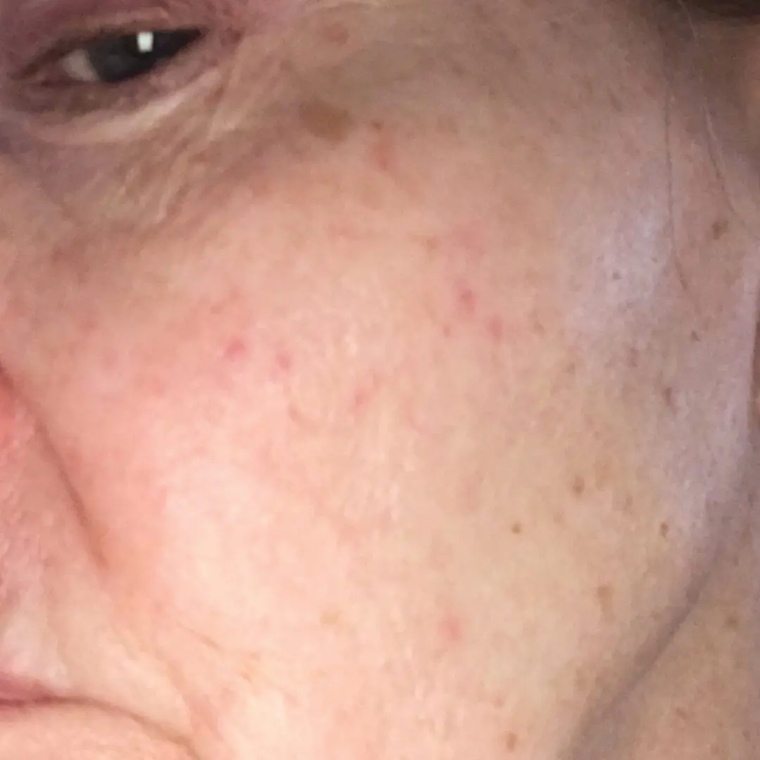 A close up of the face of an older person