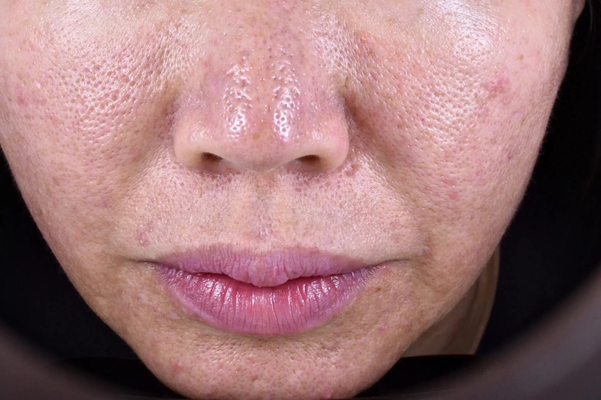 A close up of the face of a woman with wrinkles.