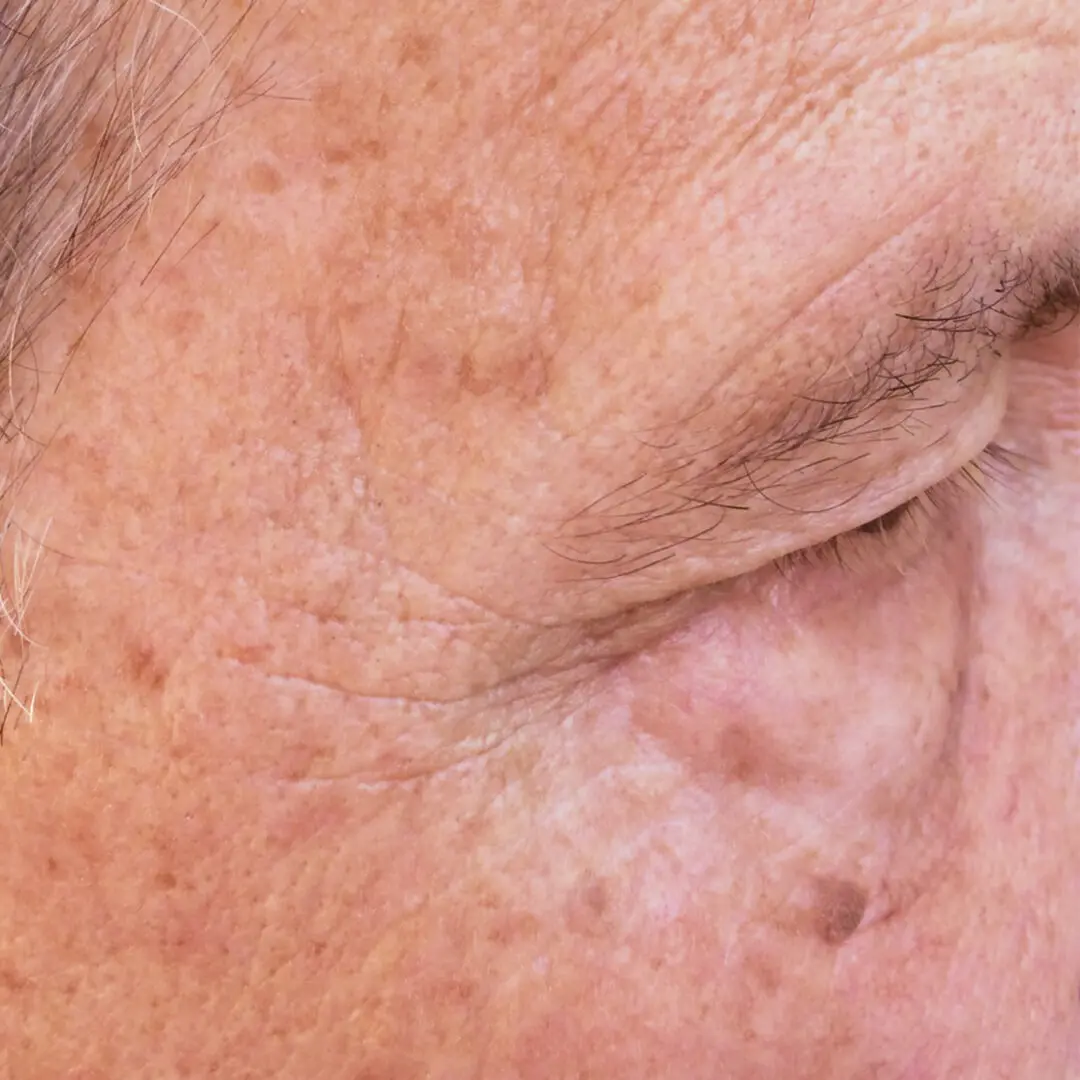 A close up of an older person 's eye