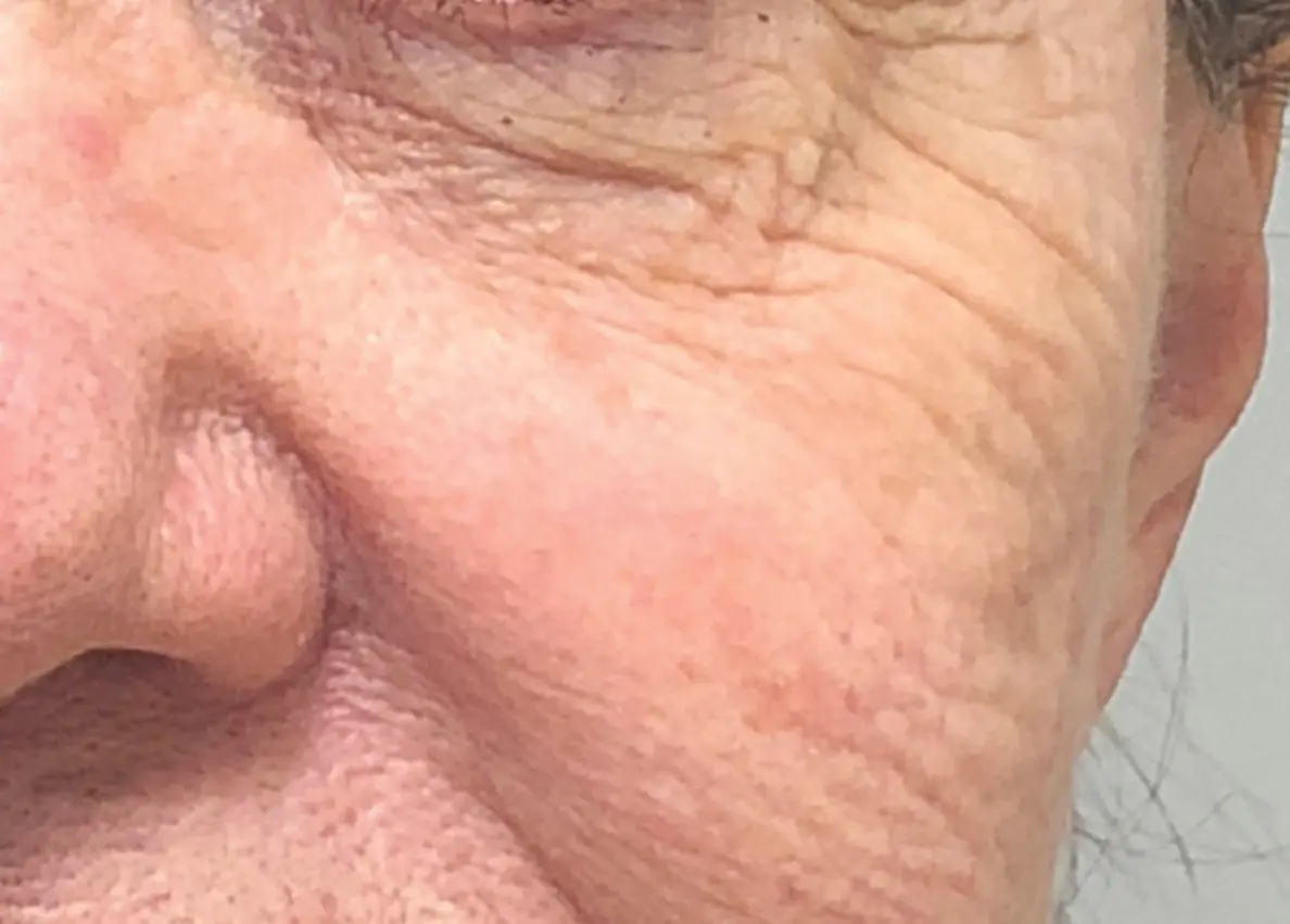 A close up of the face of an older person