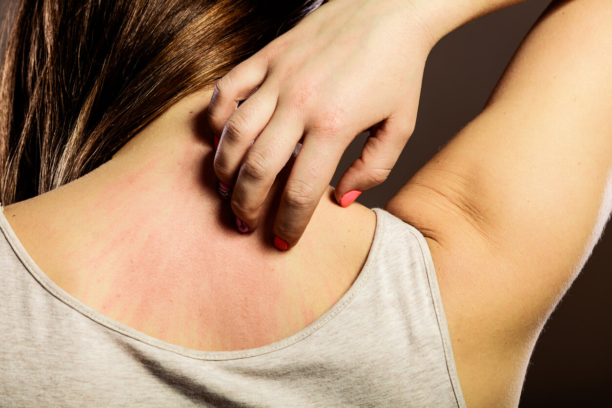 A woman scratching her back with her hand.