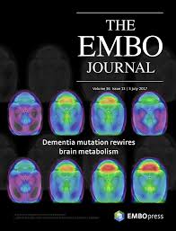 EMBO Journal cover, dementia mutation rewired brain.