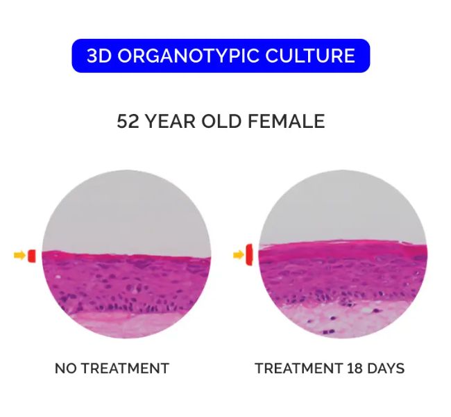 Skin tissue before and after treatment.