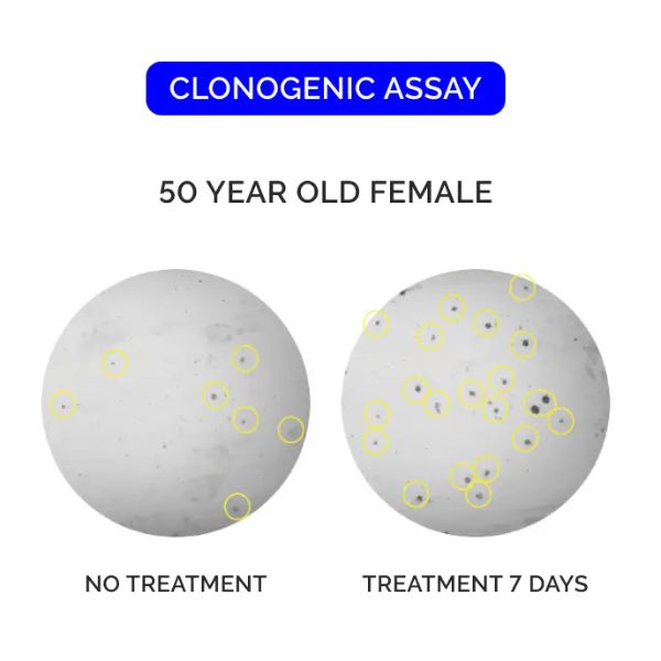 Clonogenic assay, no treatment vs 7 days.